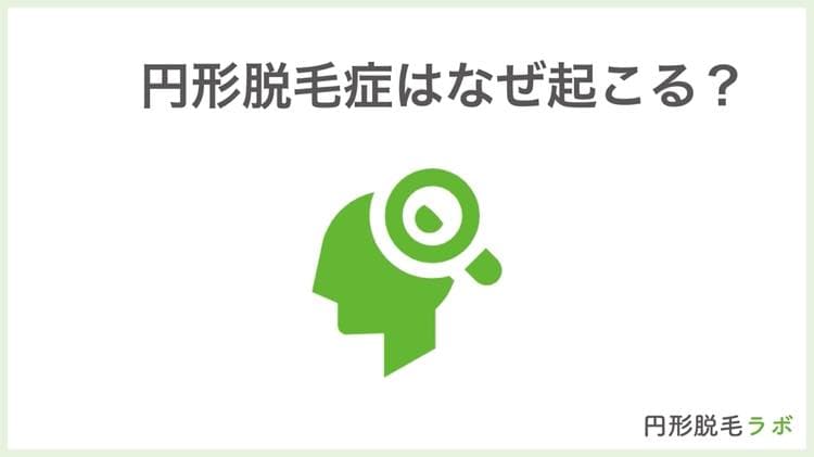 円形脱毛症はなぜ起こる?