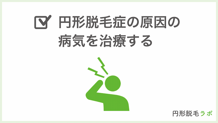 円形脱毛症の原因の病気を治療する