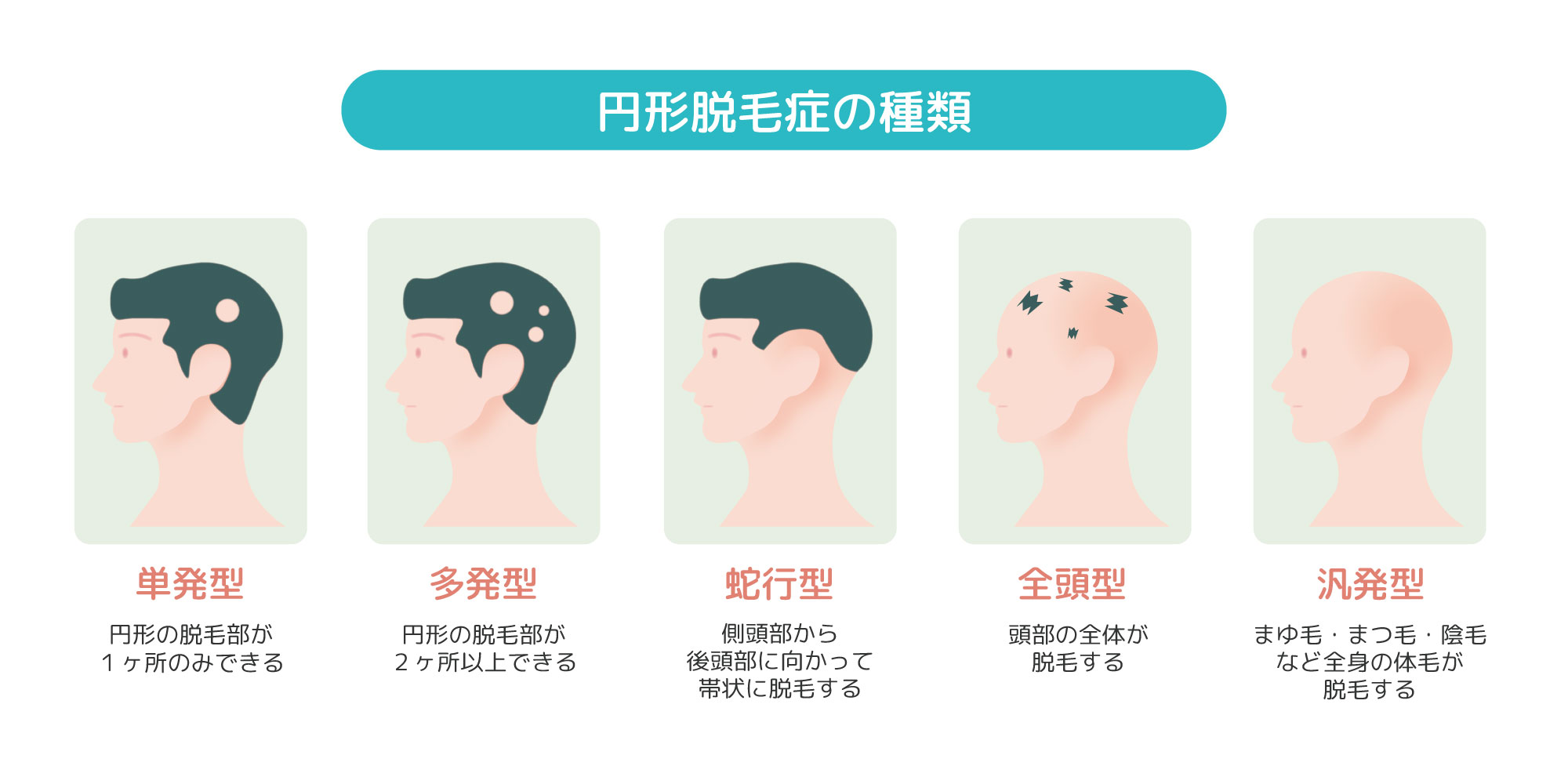 脱毛：原因と治療法