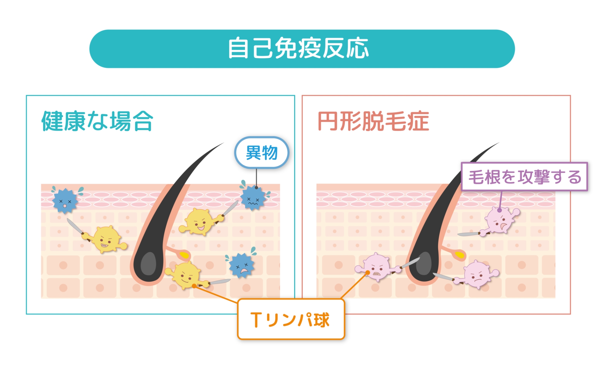 自己免疫反応