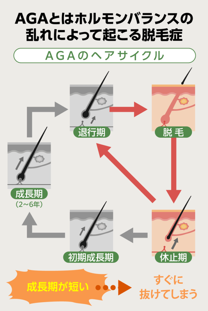 AGAになっているヘアサイクルを示す画像