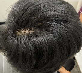 治療後